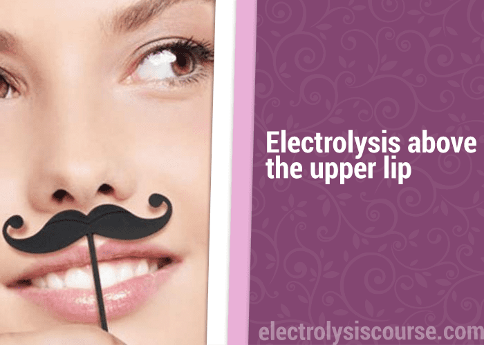 electrolysis over the upper lip