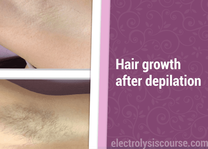 hair growth after depilation